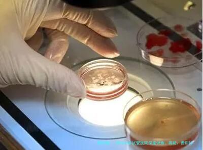 郑州46岁试管医院深度评测：高龄、费用详解与技术机构盘点，附生殖专家推荐