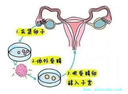 曼谷医院试管婴儿价格表