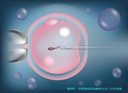 试管移植前发现囊肿怎么办？2026年最新处理策略与五大应对方案全解析